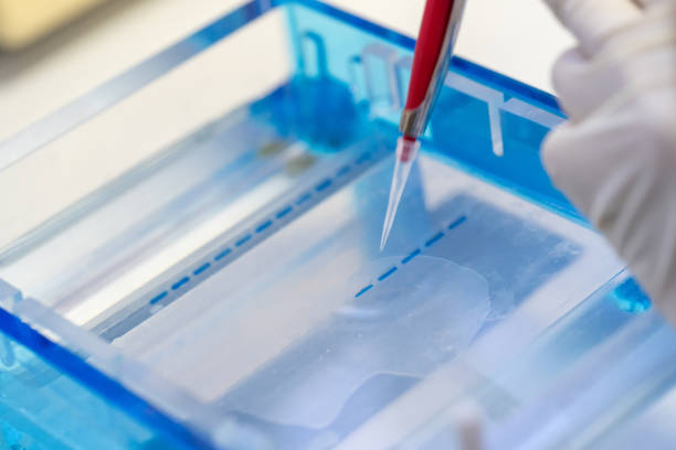 Serum Protein Electrophoresis: What Is It, and When Should It Be Done?